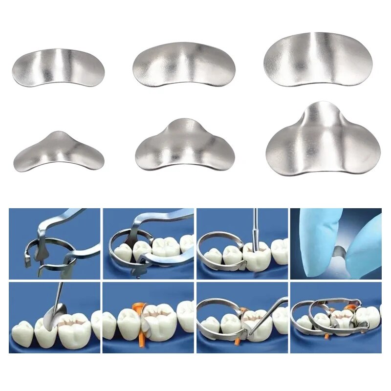 100Pcs/Box Dental Sectional Ma - Resin Art Case ulasan dan harga